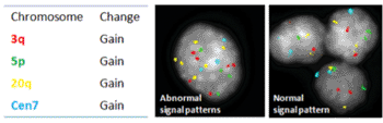 Image: The FISH-based HPV-associated Cancer Test (FHACT) is a single hybridization assay for the detection of chromosomal regions often observed early in HPV-associated precancers, and as such represent biomarkers of HPV-associated cancer progression (Photo courtesy of Cancer Genetics, Inc.).